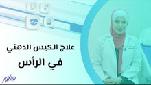 علاج الكيس الدهني في الرأس