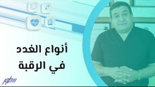 أنواع الغدد في الرقبة