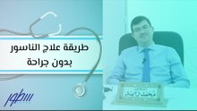طريقة علاج الناسور بدون جراحة