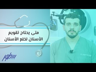 متى يحتاج تقويم الأسنان لخلع الأسنان