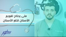 متى يحتاج تقويم الأسنان لخلع الأسنان