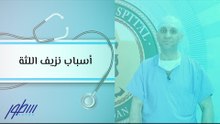 أسباب نزيف اللثة
