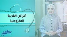 أعراض القرنية المخروطية