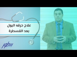 علاج حرقه البول بعد القسطرة