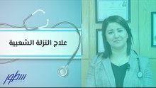 علاج النزلة الشعبية