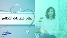 علاج فطريات الأظافر