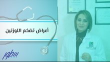 أعراض تضخم اللوزتين