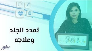 تمدد الجلد وعلاجه