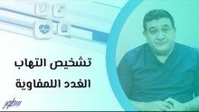 تشخيص التهاب الغدد اللمفاوية