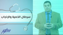 سرطان الخصية والإنجاب