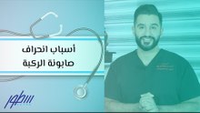 أسباب انحراف صابونة الركبة