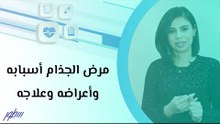 مرض الجذام أسبابه وأعراضه وعلاجه