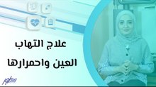 علاج التهاب العين واحمرارها