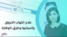 أسباب الحروق وطرق الوقاية والعلاج