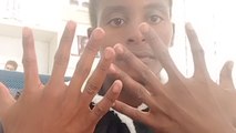 'Six Fingers Clan' - Kenyan man has 6 fully functional fingers on both hands