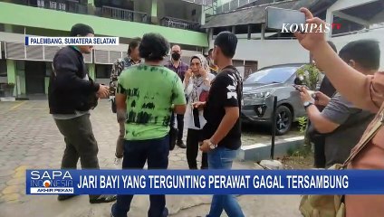 Hasil Operasi Jari Bayi yang Tergunting Perawat Gagal Tersambung