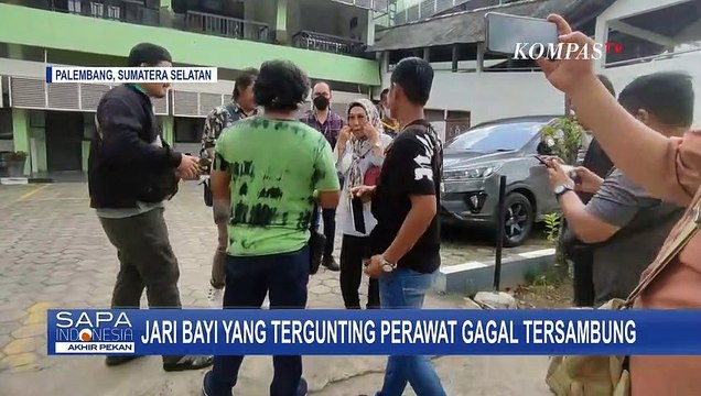 Hasil Operasi Jari Bayi yang Tergunting Perawat Gagal Tersambung