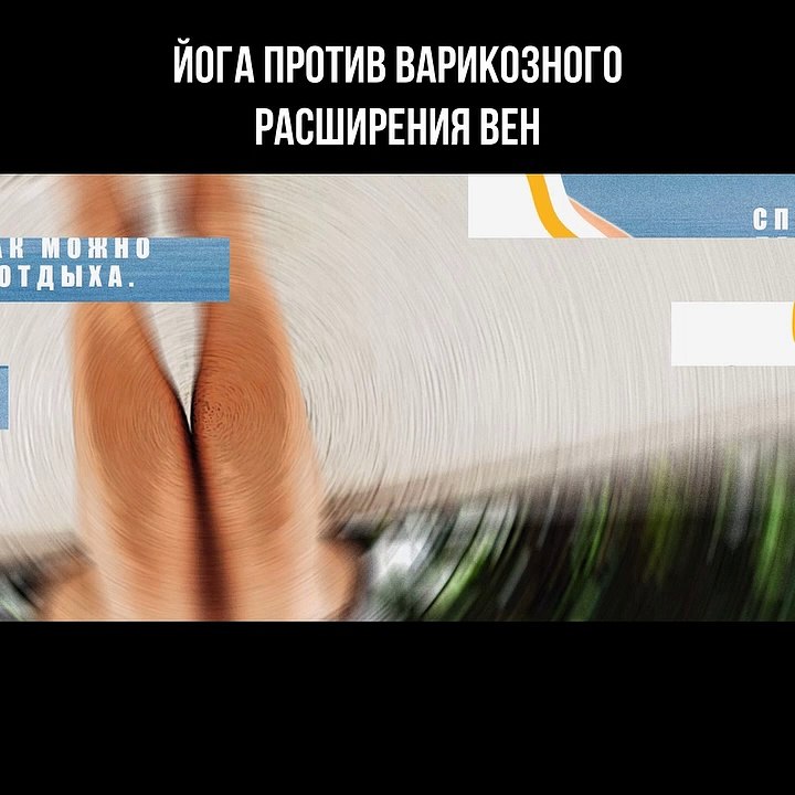 Йога против варикозного расширения вен