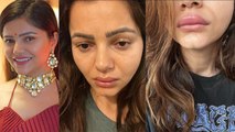 Rubina Dilaik की तबियत खराब, Lips पर आई Swelling, Post को देखकर Fans हुए परेशान | FilmiBeat