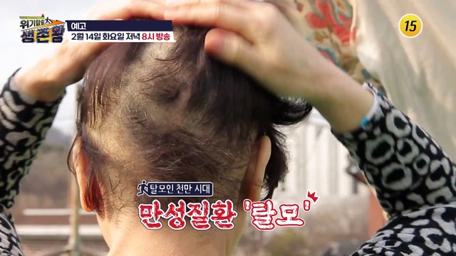 생존왕이 알려주는 모발 건강 특급 비결_위기탈출 생존왕 17회 예고 TV CHOSUN 230214 방송