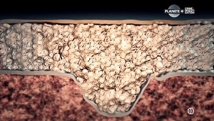 Hollywood autopsy S1E01 Michael Jackson