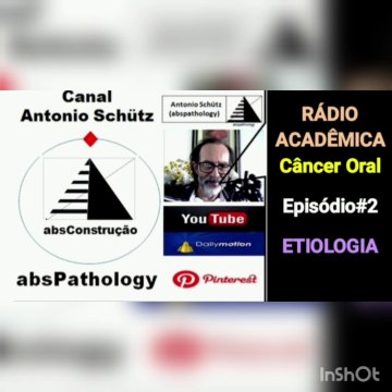 Abs Rádio |CÂNCER ORAL | ETIOLOGIA | FATORES DE RISCO