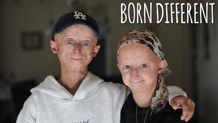 The People Who Age Too Fast | BORN DIFFERENT