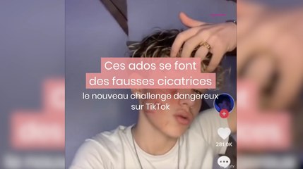 Ces ados se font des fausses cicatrices : le nouveau challenge dangereux sur Tiktok