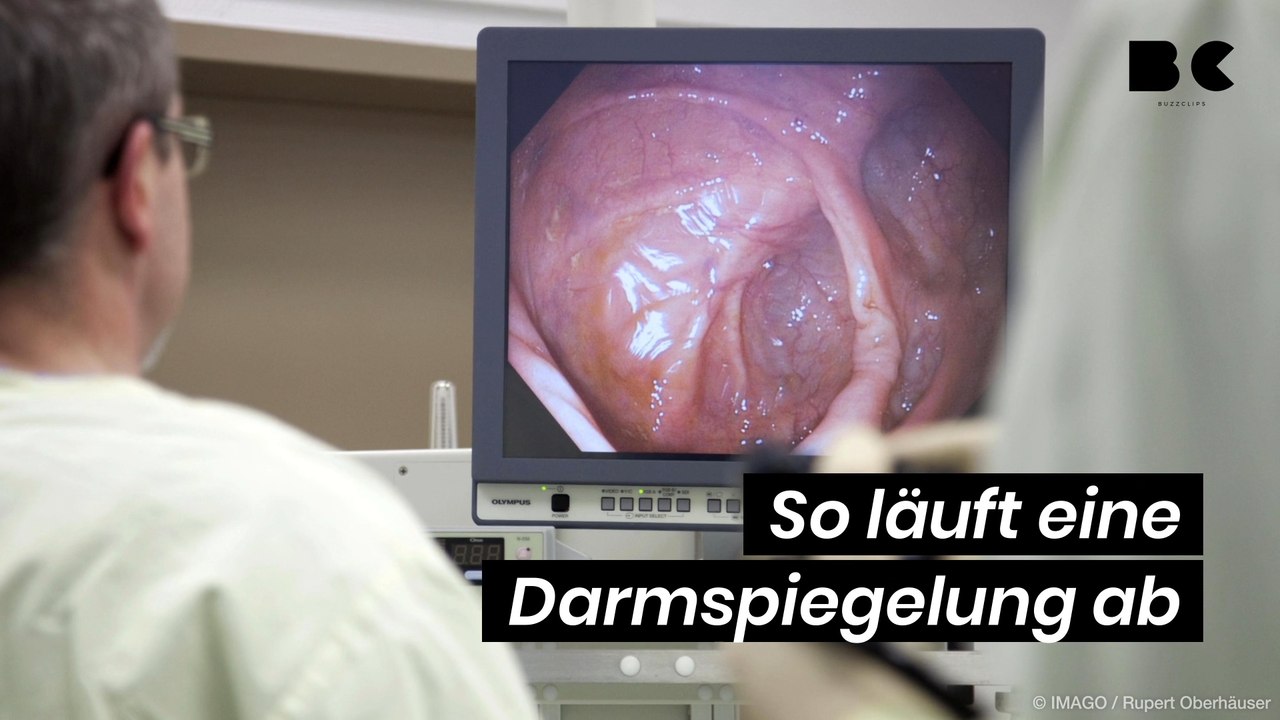 So läuft eine darmspiegelung ab