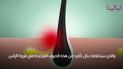فروة الرأس