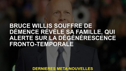 Bruce Willis souffre de démence révèle sa famille, qui alerte à la dégénérescence front-temporelle