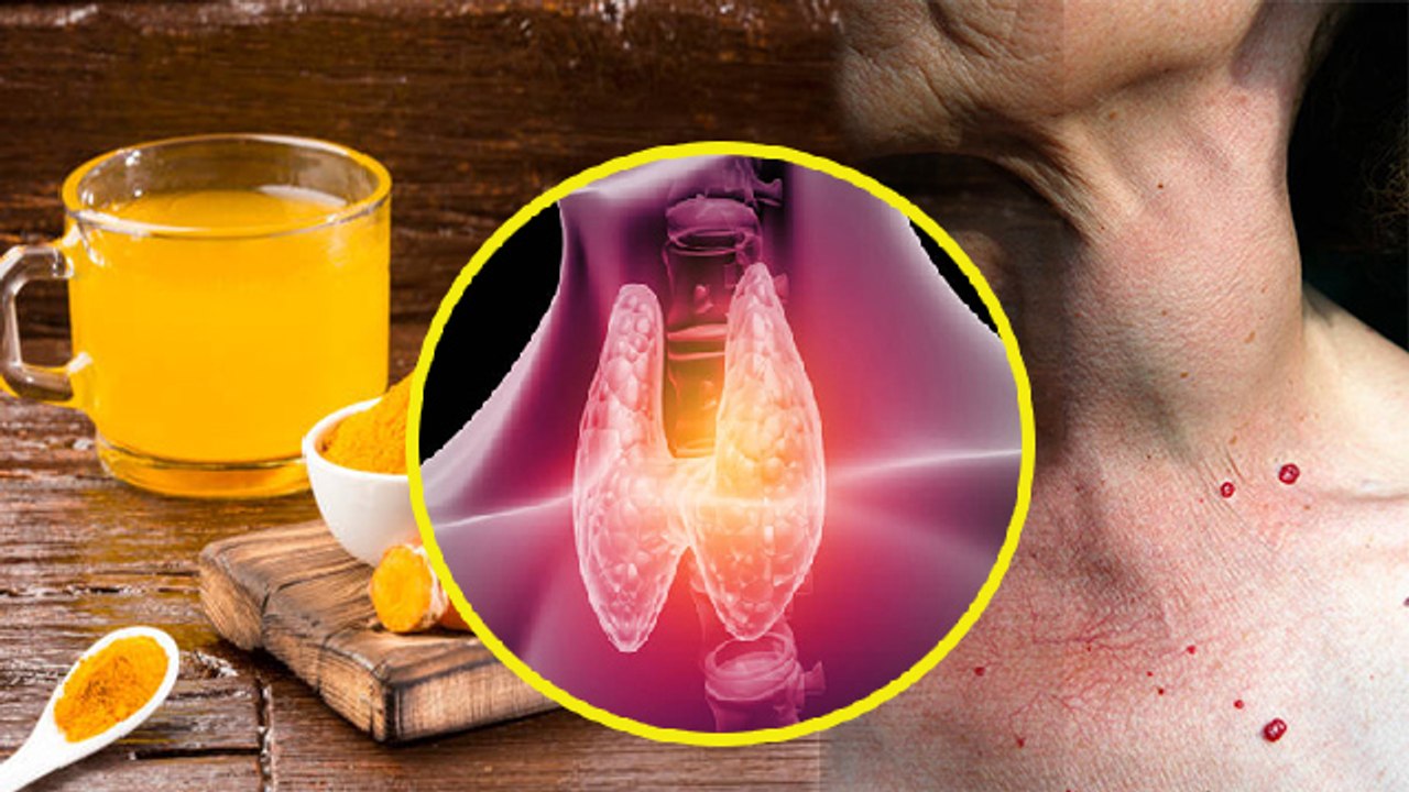Thyroid में हल्दी खाना चाहिए या नही । Thyroid में Turmeric के फायदे । Boldsky