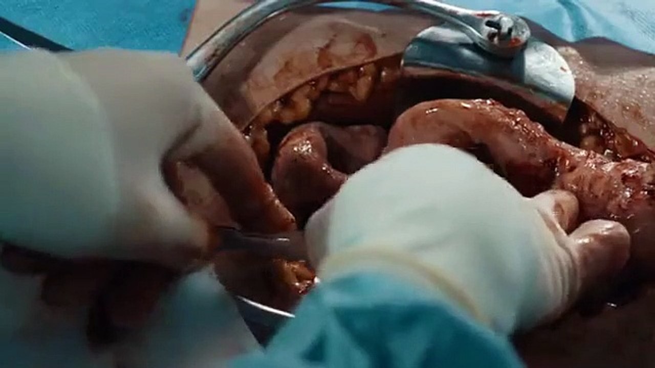 Holby City - Se23 - Ep13 HD Watch