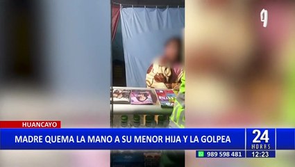 Huancayo: Detienen a mujer que quemó las manos de su hija de 9 años porque agarró dinero