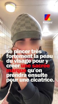 La trend des fausses cicatrices sur TikTok est très dangereuse
