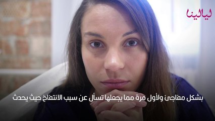 انتفاخ الجسم