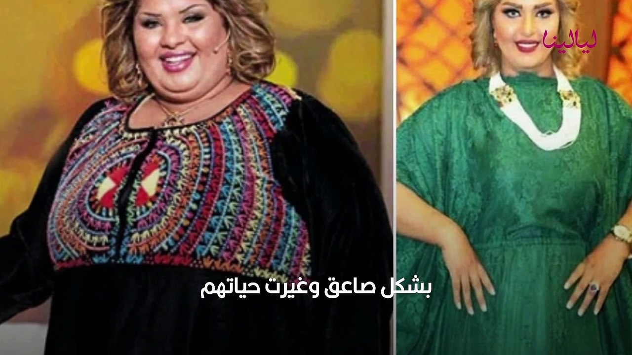 مشاهير أجروا عمليات تكميم معدة أثرت على أشكالهم بشكل صاعق وغيرت حياتهم