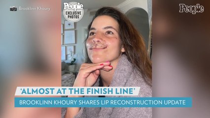 Brooklinn Khoury Reveals Results of Final Lip Reconstruction Surgery: 'Almost at the Finish Line'