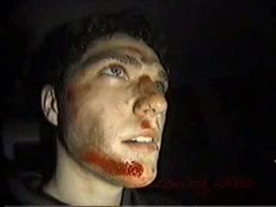 chute de bam margera en skate