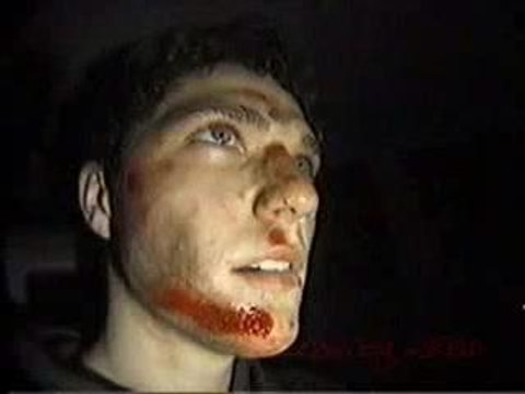 chute de bam margera en skate