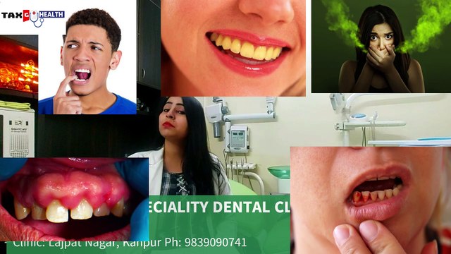 How to Maintain Oral Hygiene / Tips to Take Care of Your Dental Health in Hindi /DENTAL/TAXG HEALTH