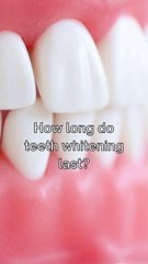 How long does teeth whitening last?