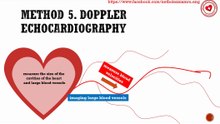 What is Doppler echocardiography?