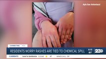 Ohio residents worry rashes are tied to chemical spill