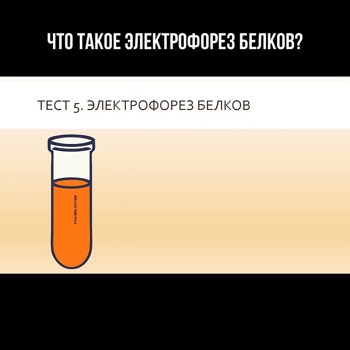 Что такое электрофорез белков?