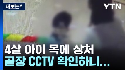 [제보는Y] 4살 목에 상처...CCTV엔 "마스크 당겨지고 머리 휘청" / YTN