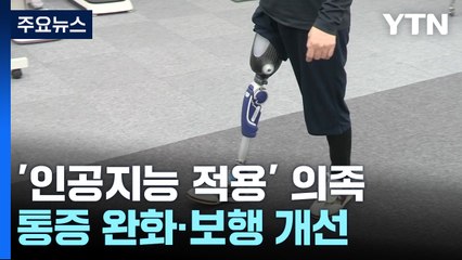 의족에 인공지능 적용했더니...통증 완화·보행 개선 / YTN