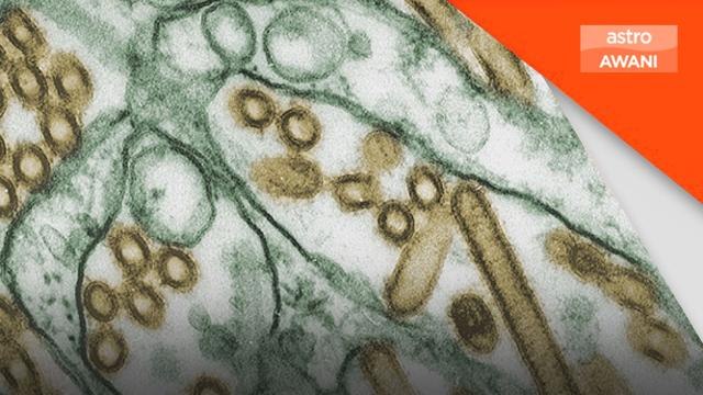 Tangani Influenza | Saintis WHO gesa bangunkan semua jenis vaksin haiwan