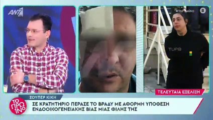 Super Κική: Άστραψε και βρόντηξε ο Λιάγκας: Τι πάει να πει δημόσιο πρόσωπο; Θα τρελαθώ τώρα