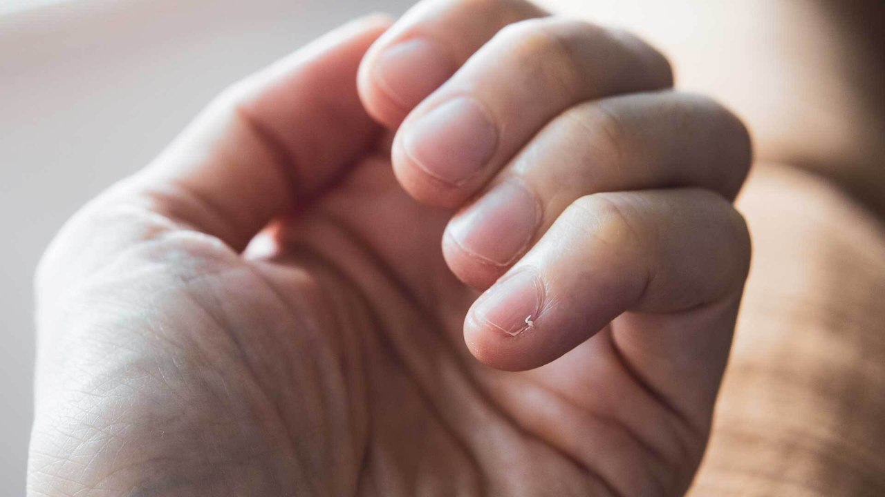 Nagelpflege: Deshalb solltet ihr Nietnägel niemals abreißen
